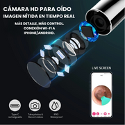 Limpia Orejas Inteligente con Cámara HD – Seguro y Preciso